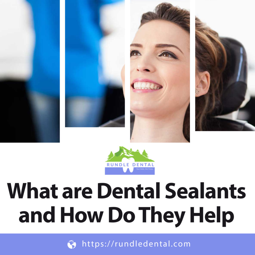 What are Dental Sealants and How Do They Help 