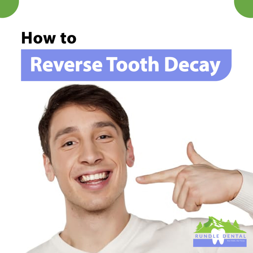  How to Reverse Tooth Decay 