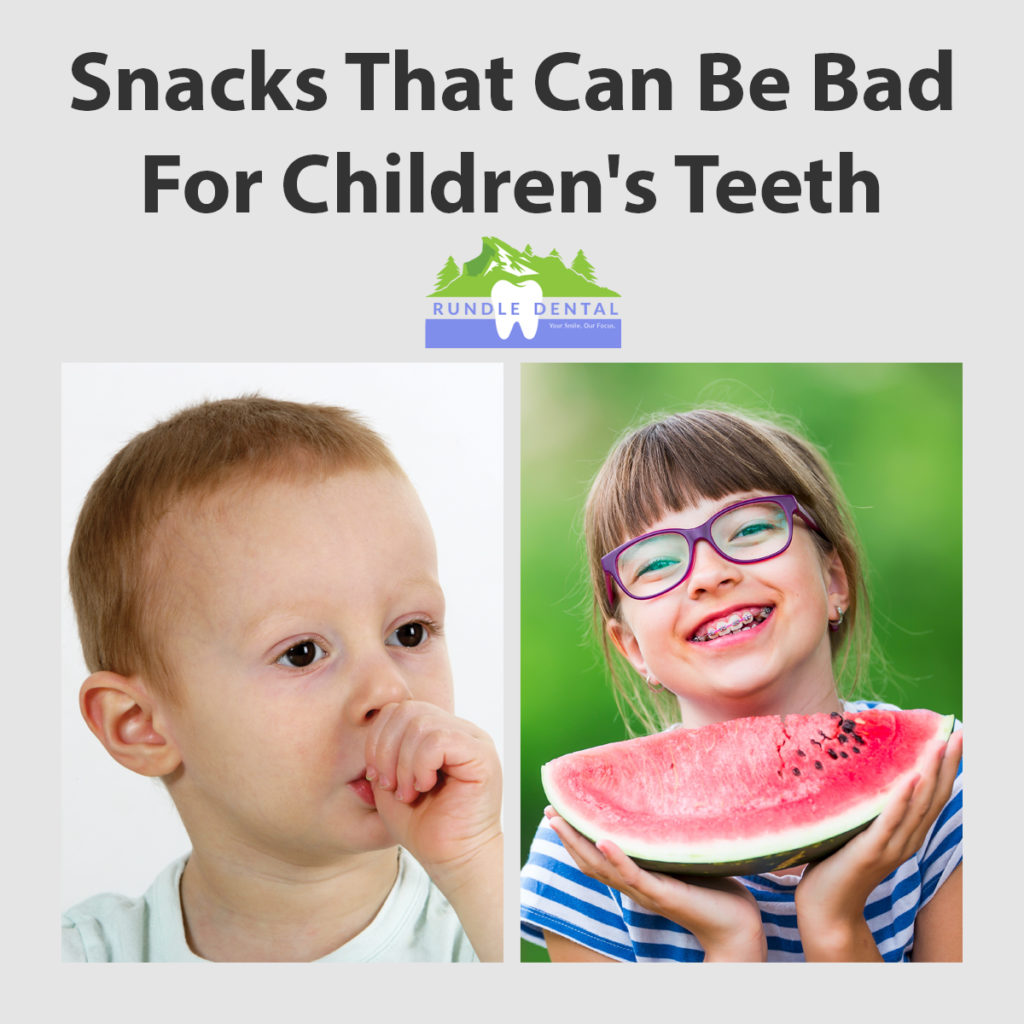 Snacks That Can Be Bad For Children's Teeth