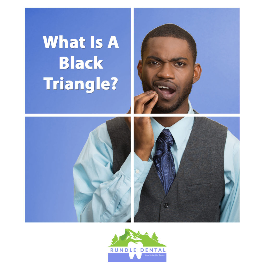 What Is A Black Triangle?  