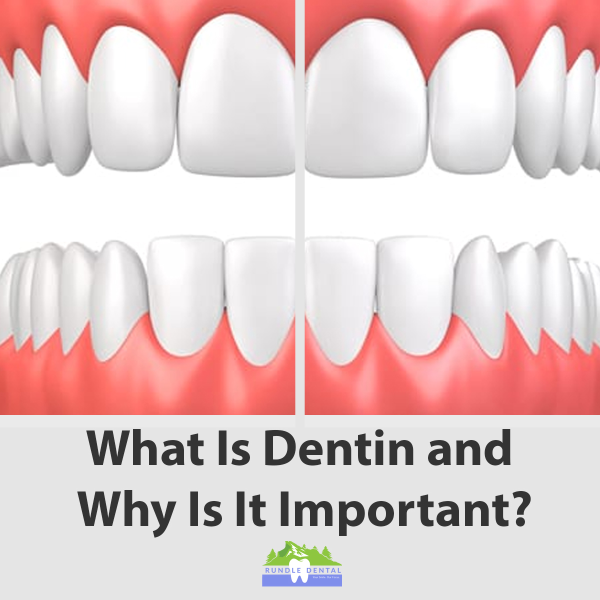  Why Are Canine Teeth Important 