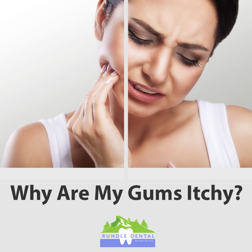 17-why-do-my-gums-itch-ezikefareeda