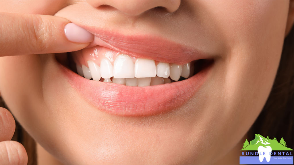 A person pointing to their gums.