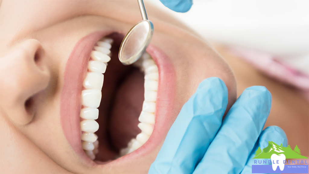 A dental mirror being held up to a patient's open mouth.